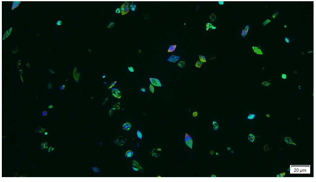 Uric Acid Crystals (polarized light, 160x)